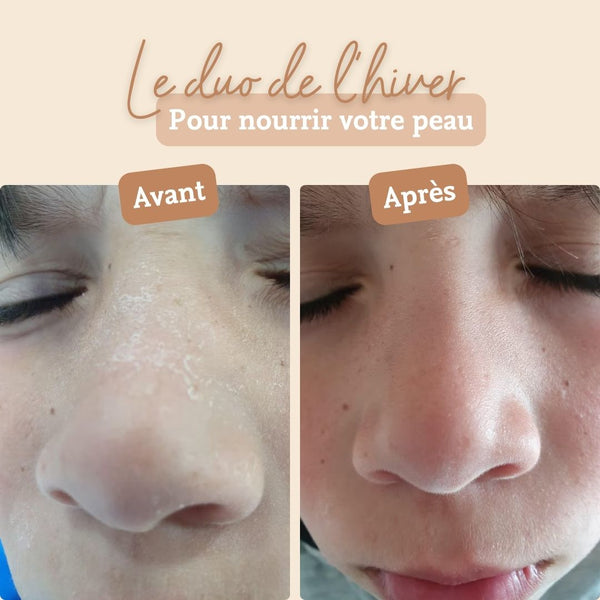 crème au beurre de karité comme avant pour nourrir la peau en hiver