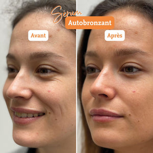 le sérum autobronzant comme avant