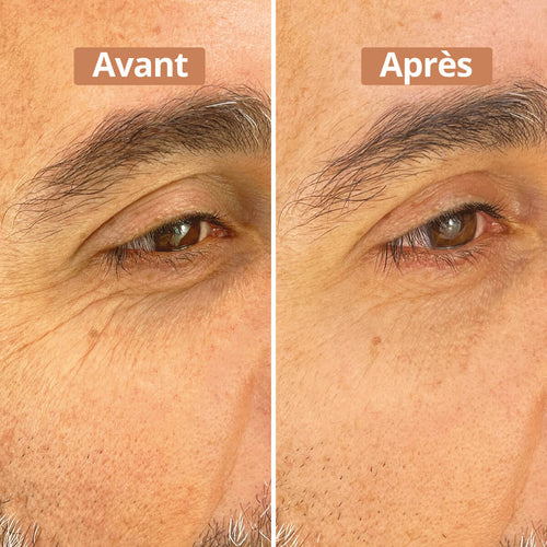 Sérum contour des yeux - Version 1