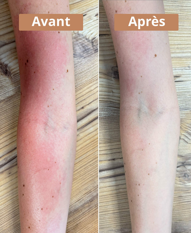 Crème solide bio et naturelle apaisante au plantain ᐅ Démangeaison — free download
