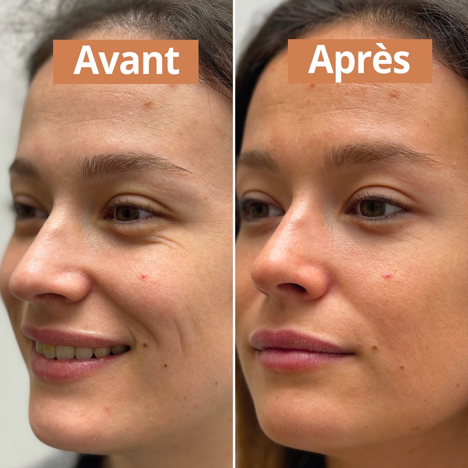 Sérum autobronzant avant apres comme avant