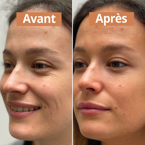 Sérum autobronzant avant apres comme avant